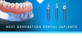 Park Dental Implants